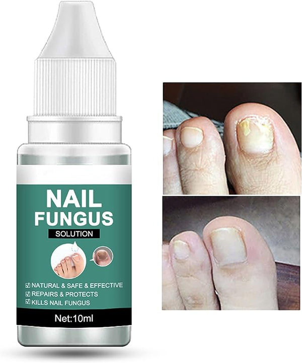 Home.co-Nail Fungus Remover